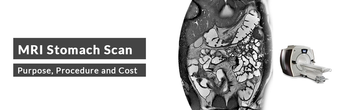 MRI Stomach Scan: Purpose, Procedure, Cost and Best MRI Centre